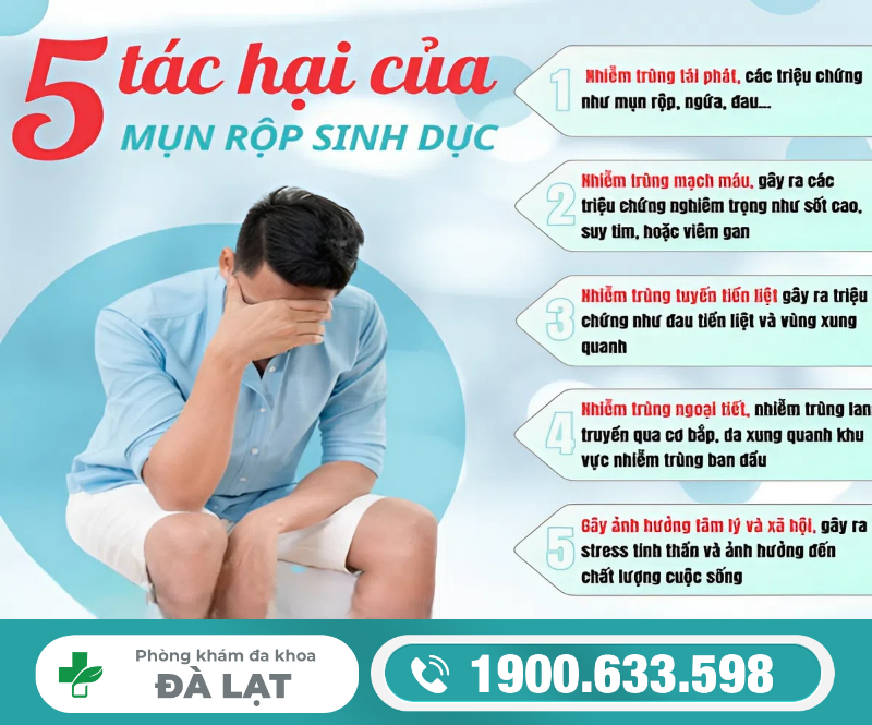 Hình ảnh minh họa